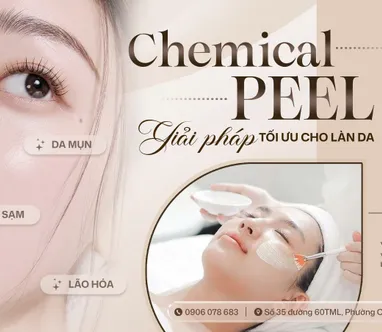 CHEMICAL PEEL – GIẢI PHÁP TỐI ƯU CHO LÀN DA MỤN, SẠM VÀ LÃO HÓA NHẸ TẠI KS BEAUTÉ SPA
