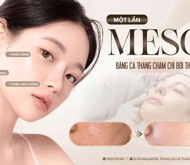 MỘT LẦN MESO – BẰNG CẢ THÁNG CHĂM CHỈ BÔI THOA