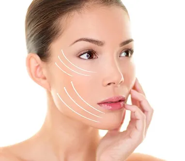 Facelift 