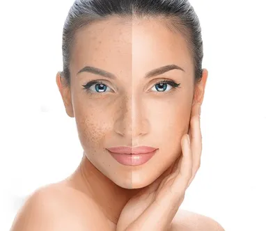 Melanin & Whitening  sáng da